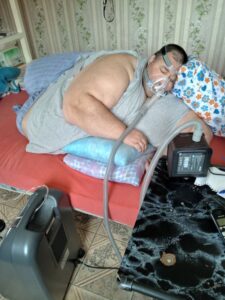 Ροδόπη: Υπέρβαρος που ζυγίζει 360 κιλά ζητά τη βοήθεια της πολιτείας