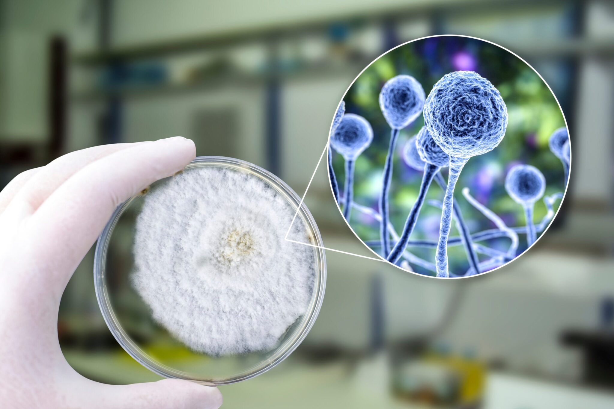 Αγωνία στους επιστήμονες για τους μύκητες Aspergillus – Μπορούν να «μας φάνε από μέσα προς τα έξω»