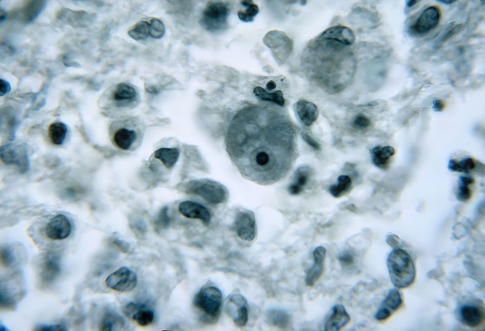 Τέξας – Naegleria fowleri: Νεκρή γυναίκα από σπάνια λοίμωξη της «αμοιβάδας που τρώει τον εγκέφαλο»