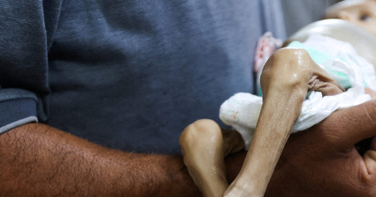 Ένας άνδρας στη Γάζα μεταφέρει τη σορό του μωρού Ζαϊνάμπ Αμπού Χαλίμπ στο Νοσοκομείο Νάσερ στην Χανου Γιουνις. Σήμερα το Ισραήλ ανακοίνωσε προκαθαριοσμένες παύσεις στρατιωτικών επιχειρήσεων προς διανομής ανθρωπιστικής βοήθειας (REUTERS/Ramadan Abed)