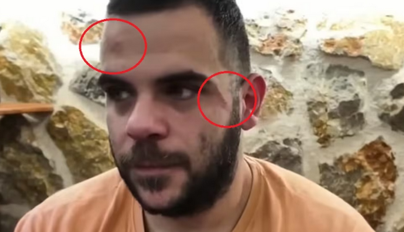 Γιάννενα: Γνωστός Youtuber από τη Θεσσαλονίκη έφαγε ξύλο σε ζωντανή μετάδοση (βίντεο)