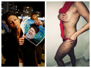 REUTERS, Instagram/sadafbaghbani - Στην πρώτη φωτογραφία μία γυναίκα διαδηλωτής στο Ιράν καίει φωτογραφία του Χαμενέι και στην δεύτερη εικόνα μία άλλη γυναίκα που φέρει τραύματα από πυροβολισμούς