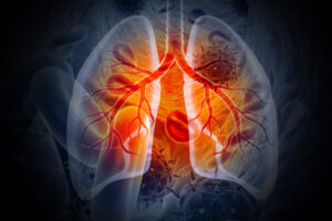 iStock