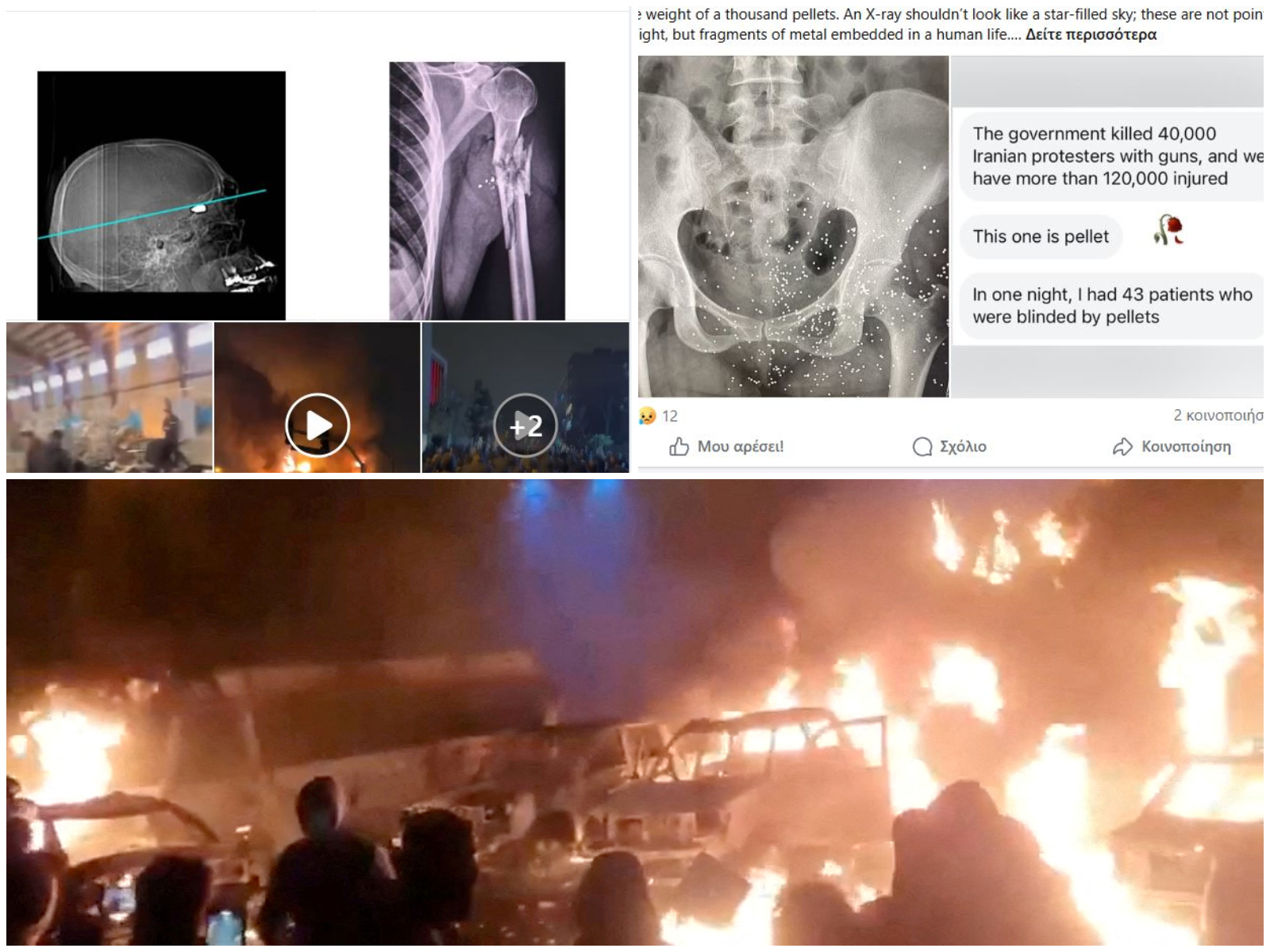 Ακτινογραφίες που σοκάρουν: Διαδηλωτές με τραύματα «πολέμου» στο Ιράν – Καταστολή που θυμίζει πεδίο μάχης